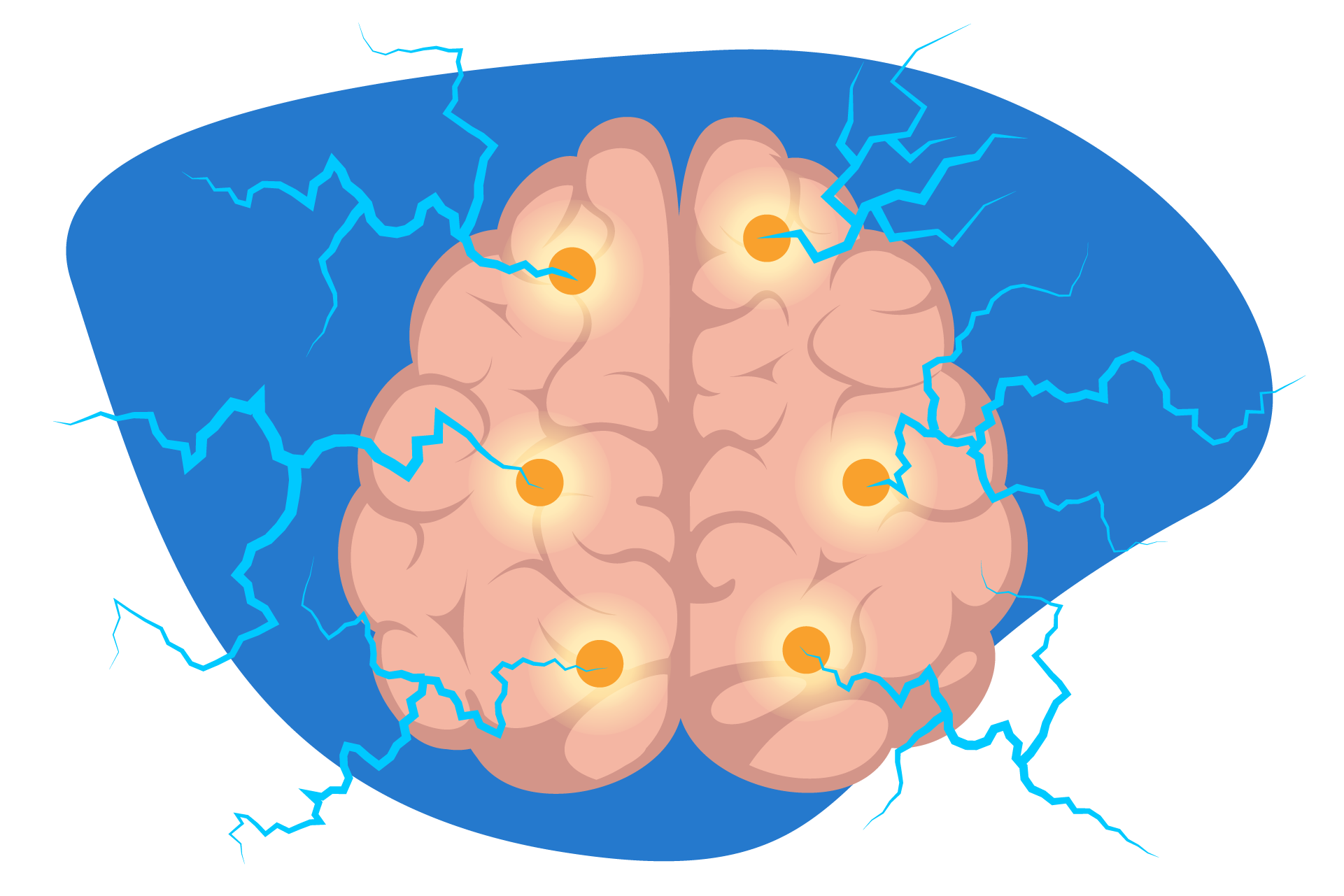 Desenho de um cérebro com diversos pontos de tensão.
